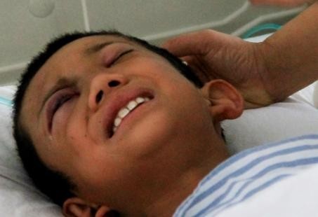 呼準公路發生校車被撞事故 7名學生受傷 呼準公路發生校車被撞事故 7名學生受傷